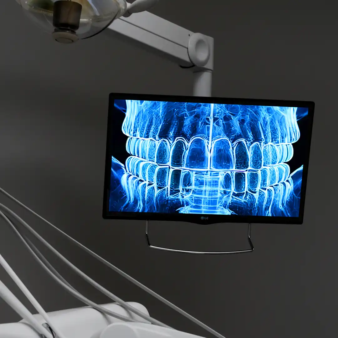 3D Print bei der Ansicht, so wie es in der Praxis üblich ist
