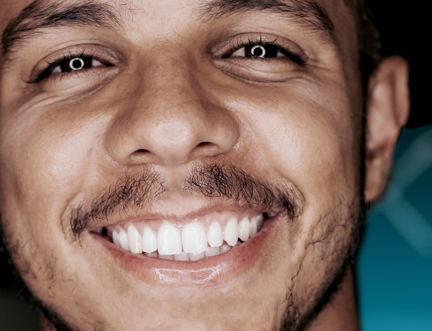Mann mit Zahnbleaching