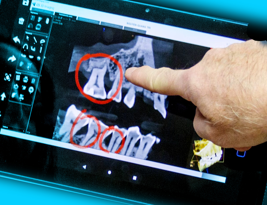 Röntgenbild zeigt die Verankerung des Zahns im Kiefer