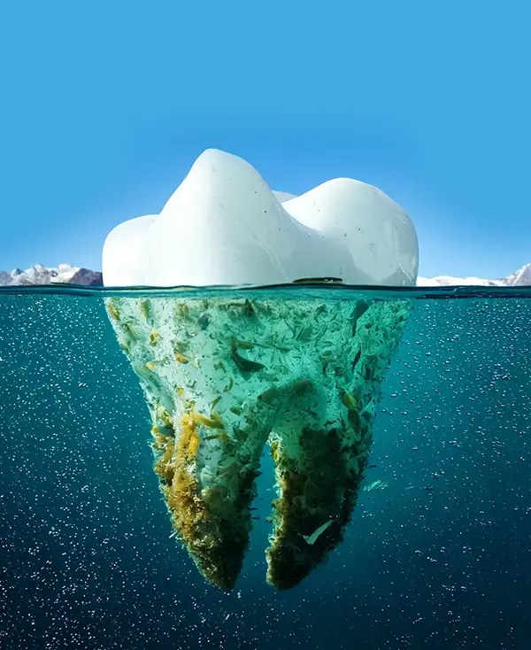 Ein Zahn als Eisberg - was unter der Oberflaeche liegt